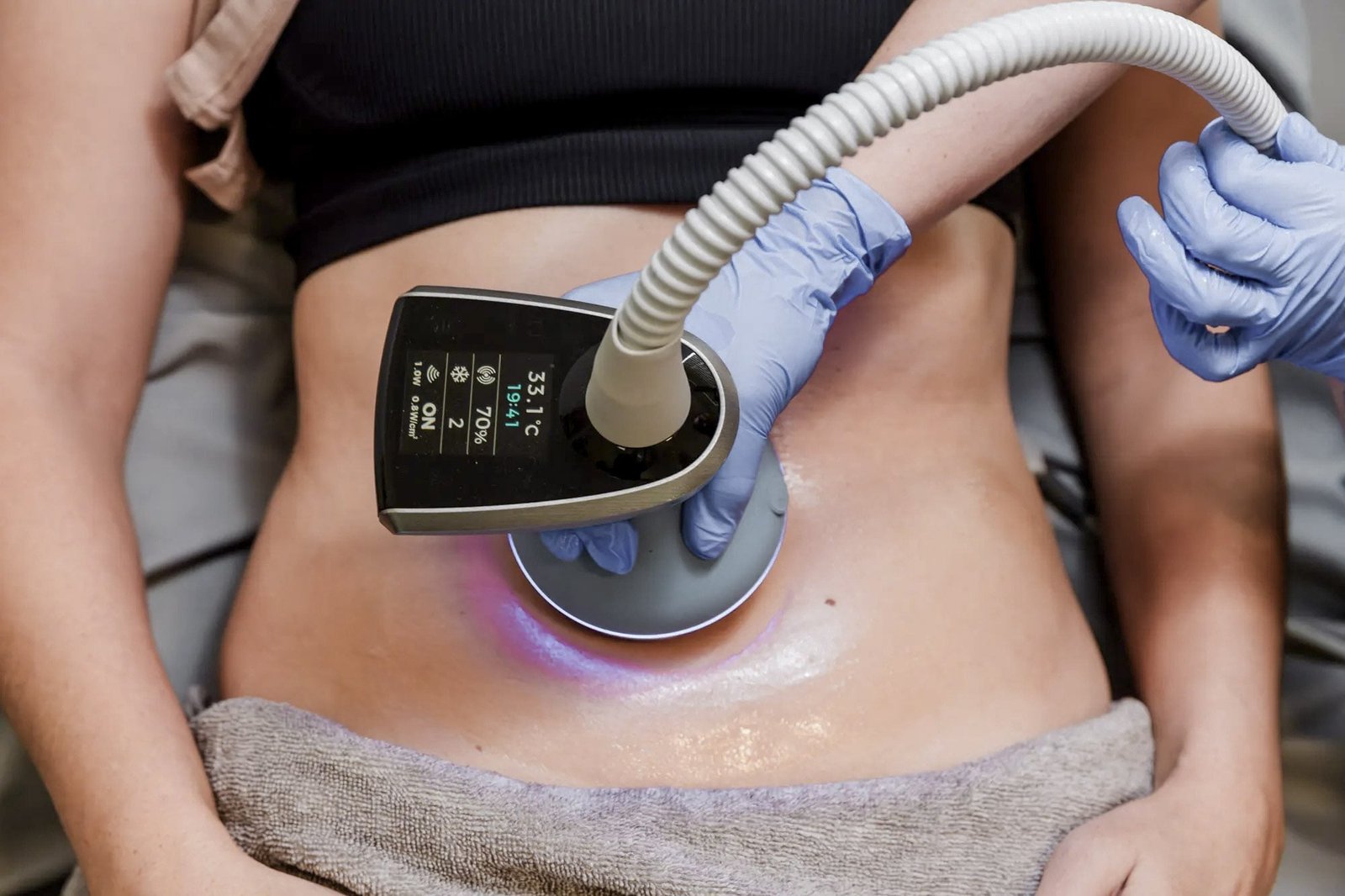 EXion: A Revolução em Tratamentos Estéticos do Grupo Paula Chicralla | Grupo Paula Chicralla exion