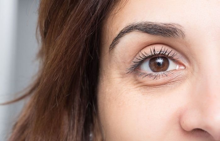 tratamento para olheiras no rio de janeiro preenchimento de olheiras